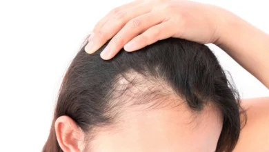 What is traction alopecia? - ट्रैक्शन एलोपेसिया क्या होता है?